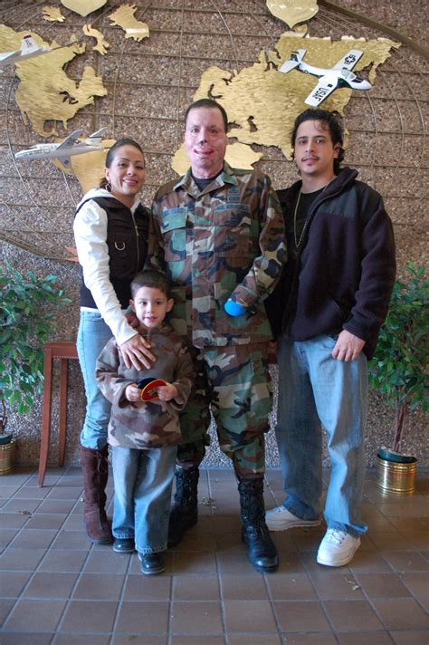 Injured Tacp Feels Lucky To Serve Air Force Display Injured Tacp Feels Lucky To Serve Air Force Display